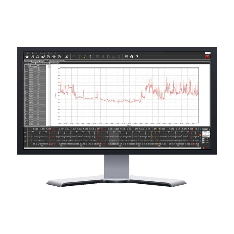 Kobold II Long-Term ECG Evaluation Package