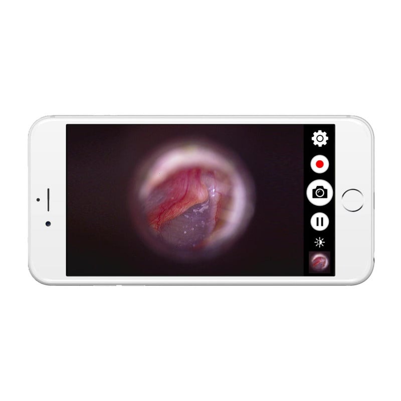 DE1270 HD Mobile Wireless Endoscope Camera