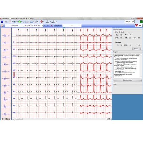 EC-12R PC Resting ECG