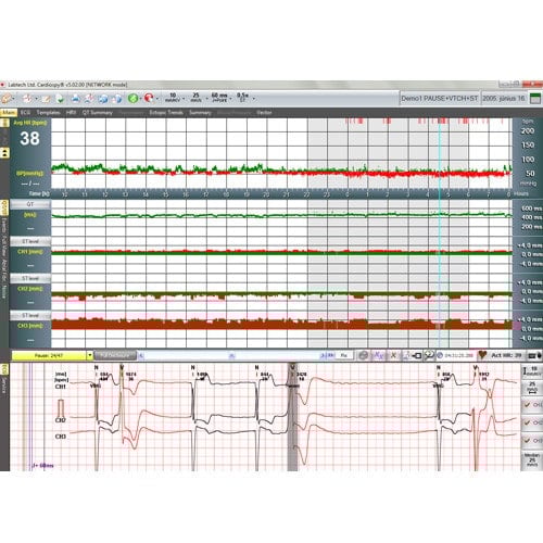 EC-3H Holter ECG System