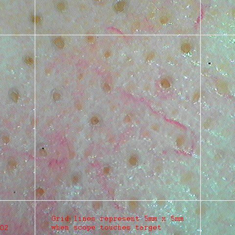 Firefly DE370 HD Mobile Wireless Polarizing Dermatoscope