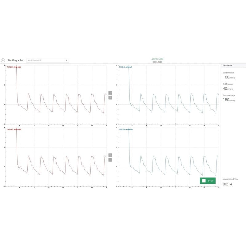 AngE™ ABI+ with TBI Add-On