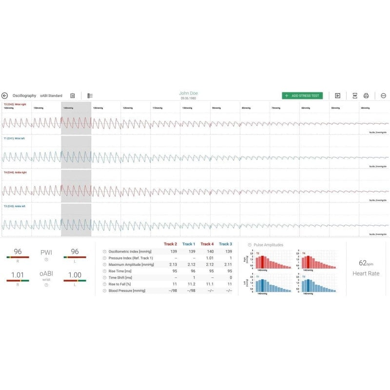 AngE™ ABI+ with TBI Add-On