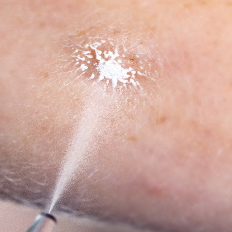 Cryoalfa SUPER Liquid | in case