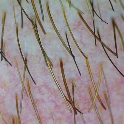 Firefly DE370 HD Mobile Wireless Polarizing Dermatoscope